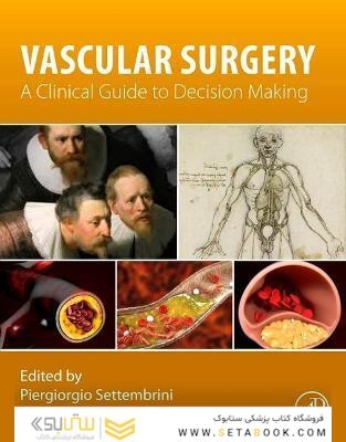 Vascular Surgery : A Clinical Guide to Decision-making2021