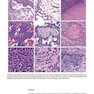 The Practice of Surgical Pathology: A Beginner
