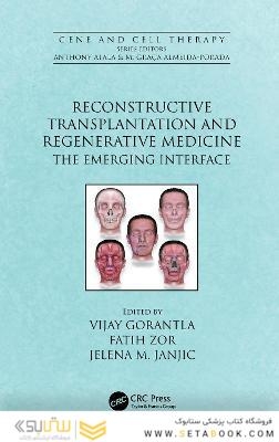 Reconstructive Transplantation and Regenerative Medicine : The Emerging Interface