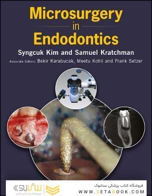 Microsurgery in Endodontics