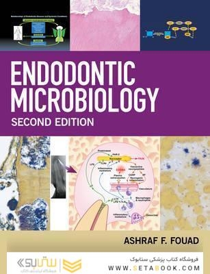 Endodontic Microbiology