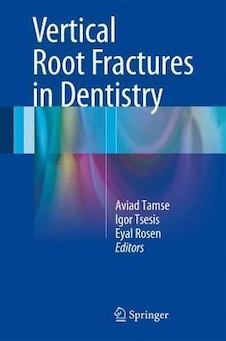 عکس Vertical Root Fractures in Dentistry