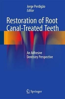 عکس Restoration of Root Canal-Treated Teeth : An Adhesive Dentistry Perspective