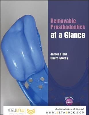 Removable Prosthodontics at a Glance