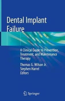 عکس Dental Implant Failure : A Clinical Guide to Prevention, Treatment, and Maintenance Therapy