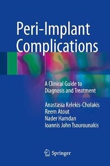 عکس Peri-Implant Complications : A Clinical Guide to Diagnosis and Treatment