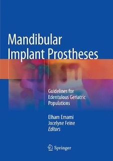 عکس Mandibular Implant Prostheses : Guidelines for Edentulous Geriatric Populations
