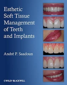 عکس Esthetic Soft Tissue Management of Teeth and Implants