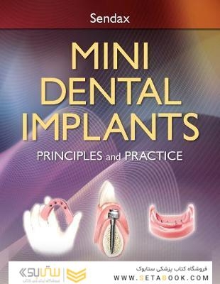 Mini Dental Implants : Principles and Practice