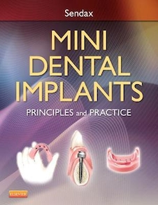 عکس Mini Dental Implants : Principles and Practice