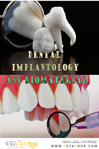 Dental Implantology and Biomaterial
