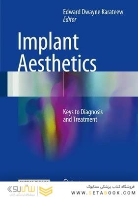 Implant Aesthetics