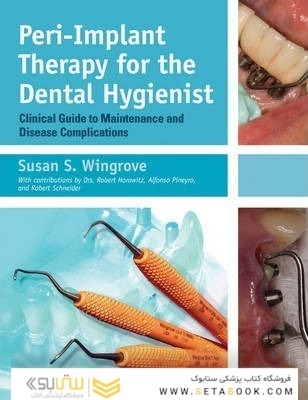 Peri-Implant Therapy for the Dental Hygienist : Clinical Guide to Maintenance and Disease Complications