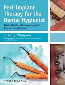عکس Peri-Implant Therapy for the Dental Hygienist : Clinical Guide to Maintenance and Disease Complications