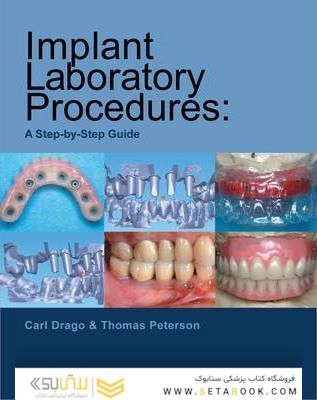 Implant Laboratory Procedures : A Step-by-Step Guide