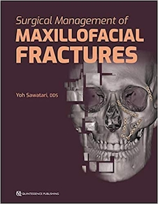 عکس Surgical Management of Maxillofacial Fractures