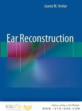 Ear Reconstruction