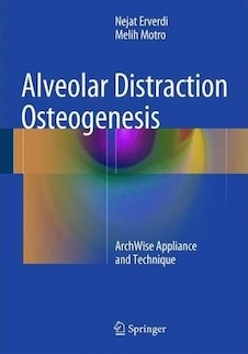 عکس Alveolar Distraction Osteogenesis