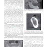 Color Atlas of Dental Implant Surgery 4th Edicion 2015