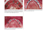 Color Atlas of Dental Implant Surgery 4th Edicion 2015