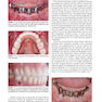 Color Atlas of Dental Implant Surgery 4th Edicion 2015