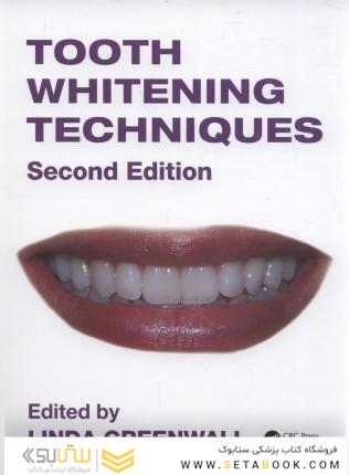 Tooth Whitening Techniques
