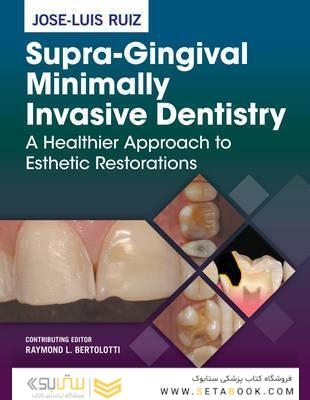 Supra-Gingival Minimally Invasive Dentistry