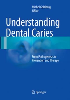 عکس Understanding Dental Caries