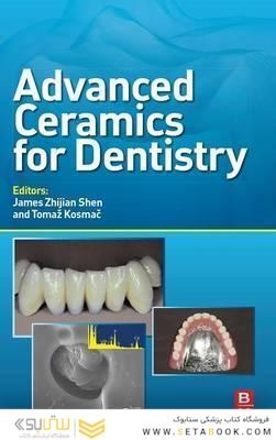 Advanced Ceramics for Dentistry