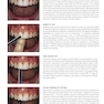 Traumatic Dental Injuries : A Manual