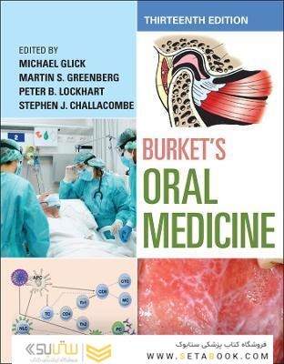 Burket