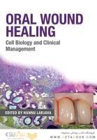Oral Wound Healing