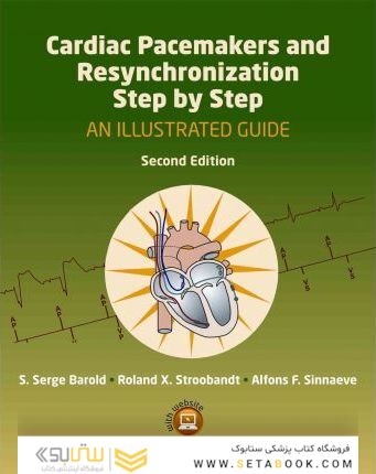 Cardiac Pacemakers and Resynchronization Step by Step