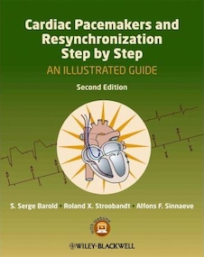 عکس Cardiac Pacemakers and Resynchronization Step by Step
