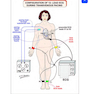 Cardiac Pacemakers and Resynchronization Step by Step