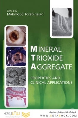 Mineral Trioxide Aggregate