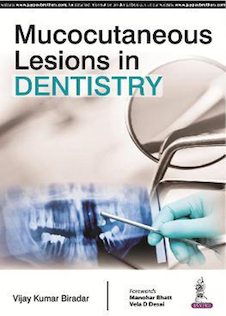 عکس Mucocutaneous Lesions in Dentistry