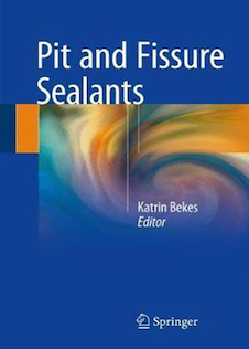 عکس Pit and Fissure Sealants 2018