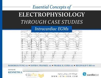 Essential Concepts of Electrophysiology Through Case Studies2015
