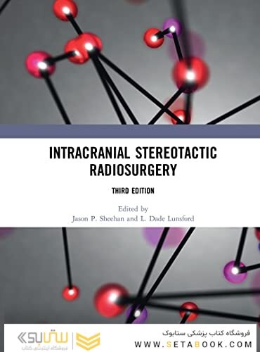 Intracranial Stereotactic Radiosurgery 2021