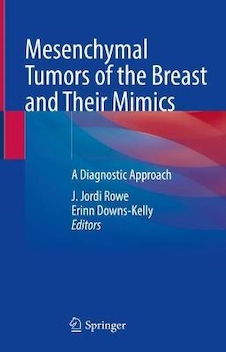 عکس Mesenchymal Tumors of the Breast and Their Mimics