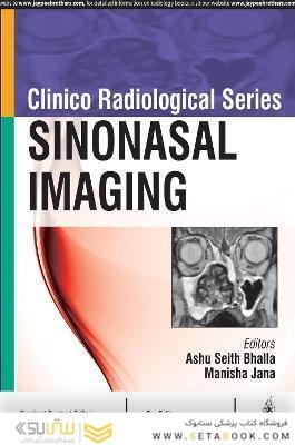 Clinico Radiological Series: Sinonasal Imaging