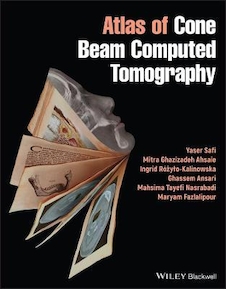 عکس Atlas of Cone Beam Computed Tomography 2022