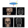 Atlas of Cone Beam Computed Tomography 2022