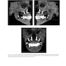 Atlas of Cone Beam Computed Tomography 2022