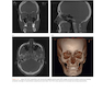 Atlas of Cone Beam Computed Tomography 2022
