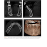 Atlas of Cone Beam Computed Tomography 2022