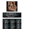 Atlas of Cone Beam Computed Tomography 2022