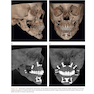 Atlas of Cone Beam Computed Tomography 2022
