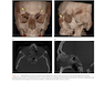 Atlas of Cone Beam Computed Tomography 2022